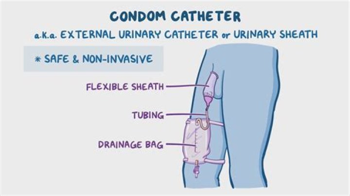 Can condom catheters cause UTI