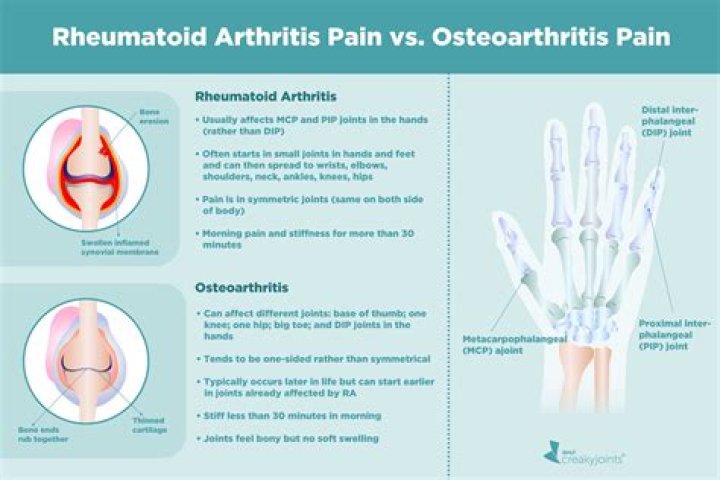 Can osteoarthritis cripple you