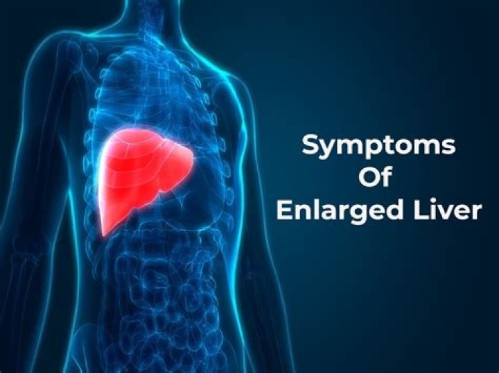 Can you feel an enlarged liver