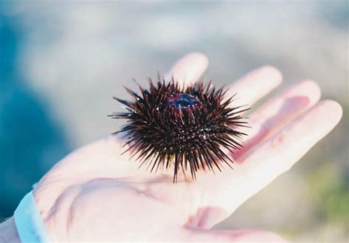 Does urine cure sea urchin stings