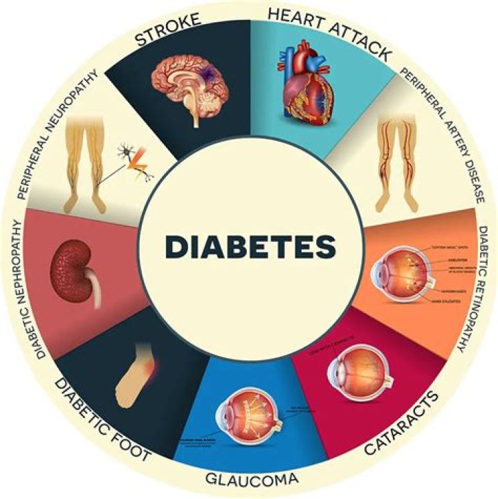 Is diabetes a serious disease