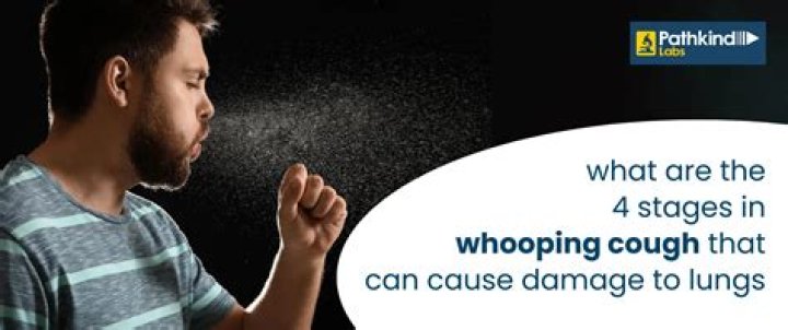 Is whooping cough going around