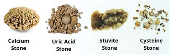 What are litho stones made of