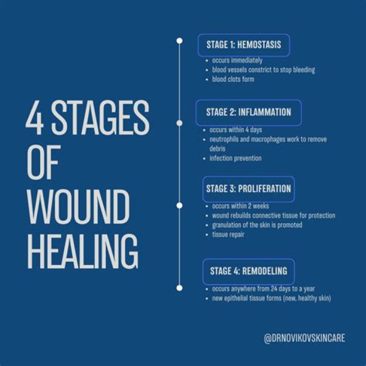 What are the stages of surgery