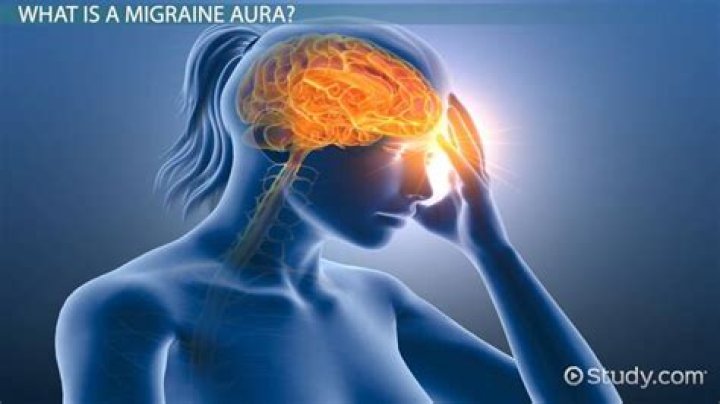 What color are migraine auras
