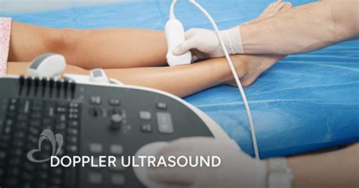 What does a Doppler test tell you