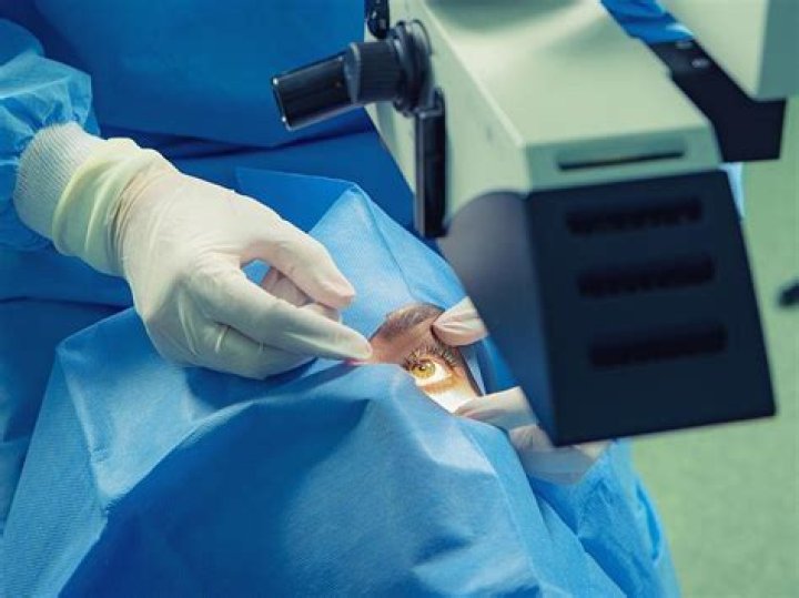 What is a Mullerectomy