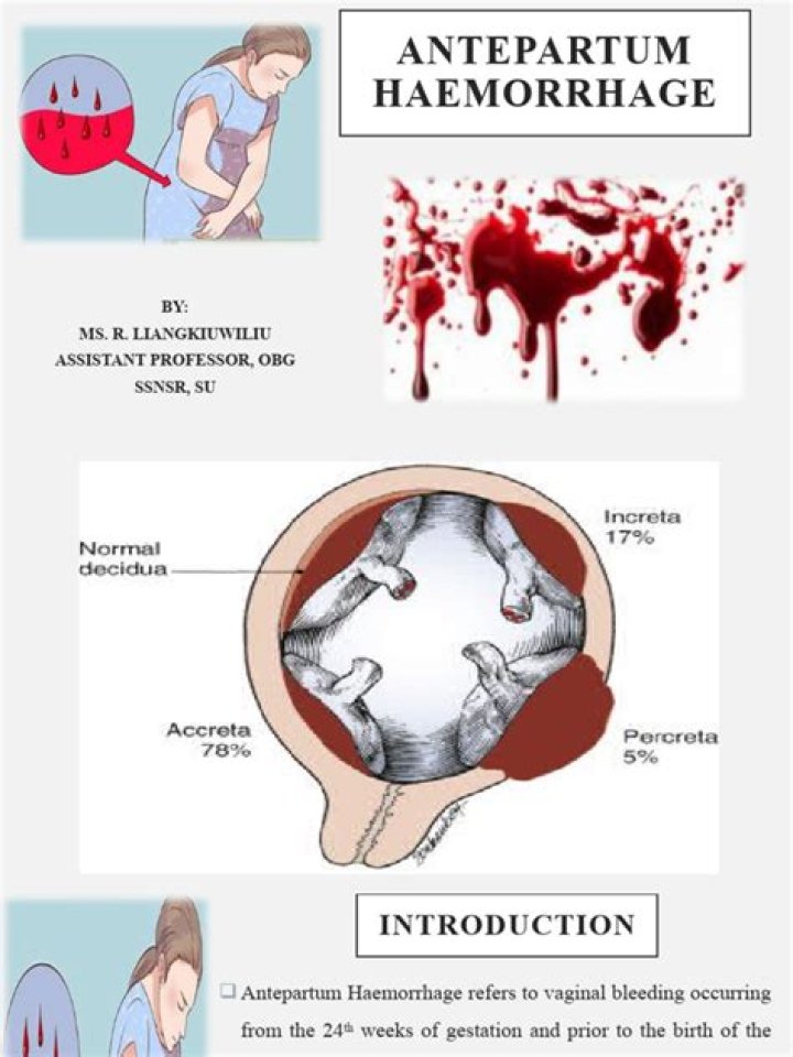 What is antepartum haemorrhage