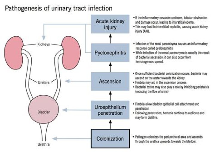 What is B coli infection in urine