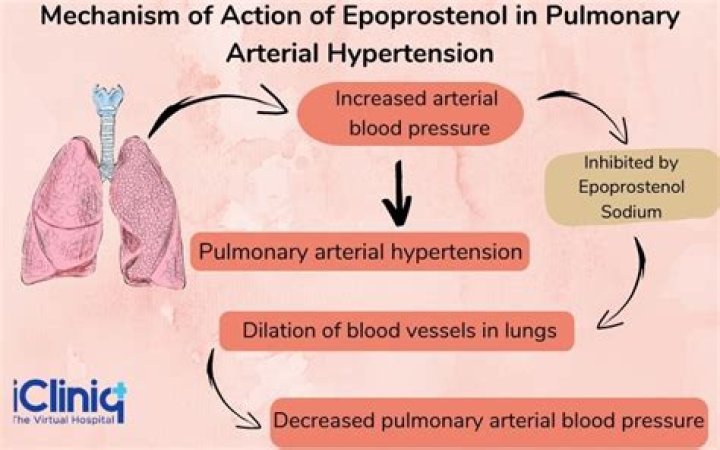 What is epoprostenol used for
