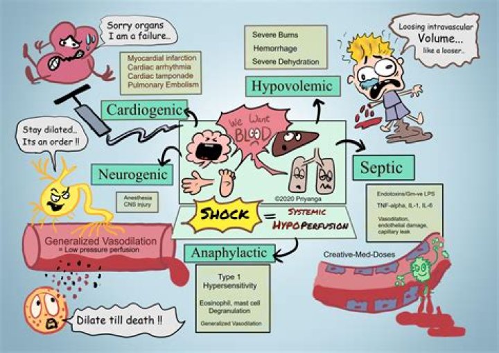 What is systemic hypoperfusion